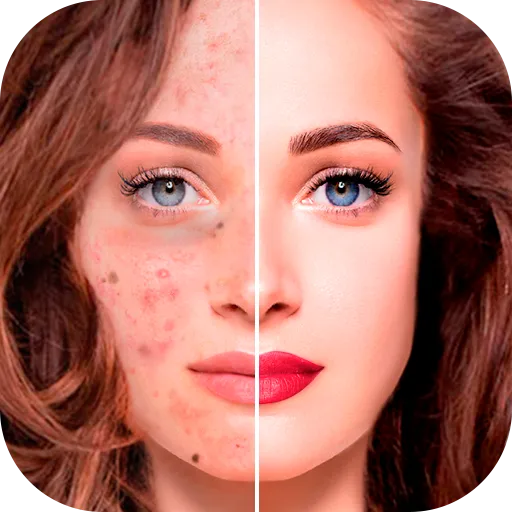 Blemish Remover - Face Editor