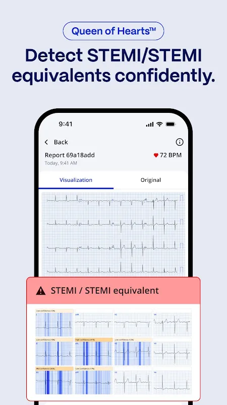 PMcardio for Individuals PMcardio for Individuals
