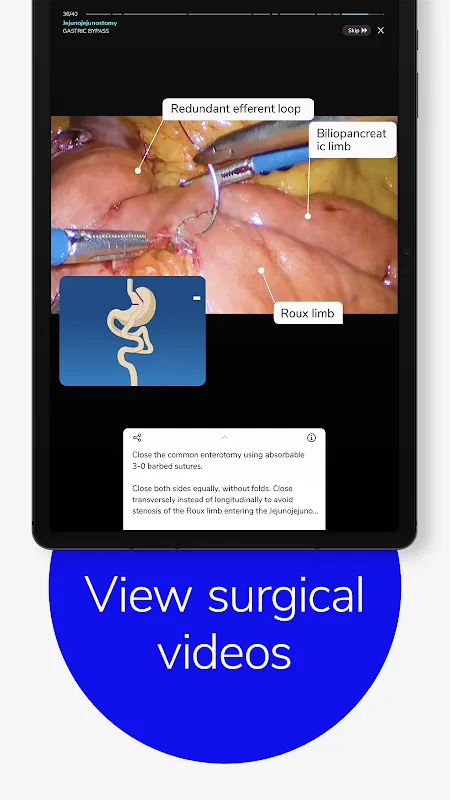 Touch Surgery Touch Surgery