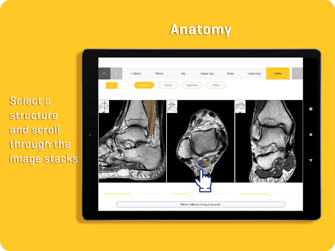 MRI Essentials MRI Essentials