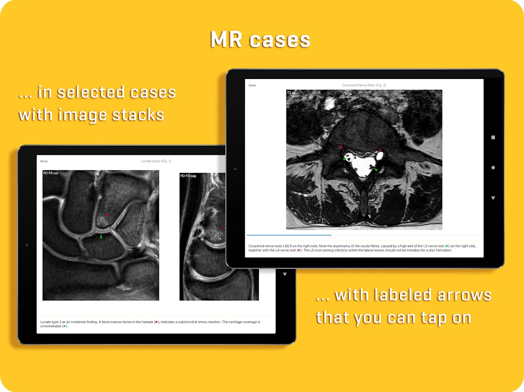 MRI Essentials MRI Essentials
