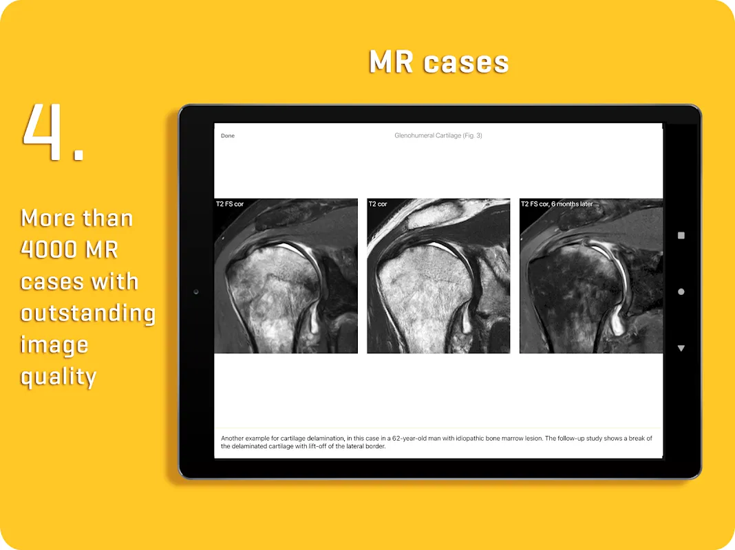 MRI Essentials MRI Essentials