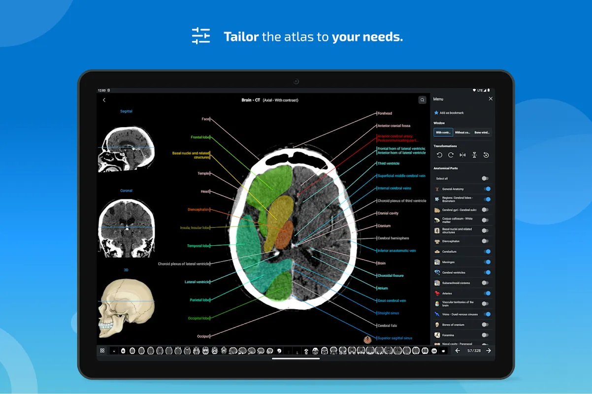 IMAIOS e-Anatomy IMAIOS e-Anatomy